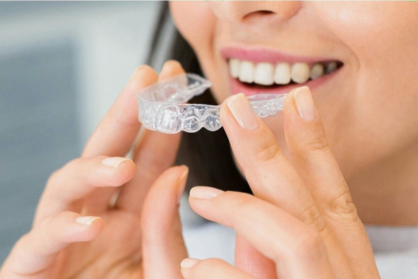 Frau die Invisalign Schiene in den Mund einsetzt