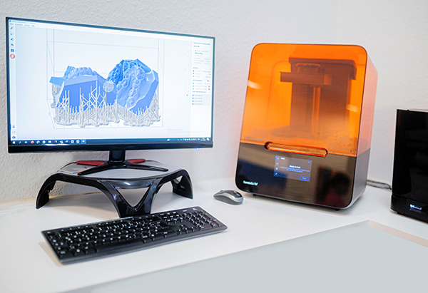 Digitaler Intraoralscanner